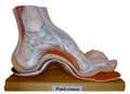 Semelles orthopédiques sur mesure pour pieds creux / sur RDV