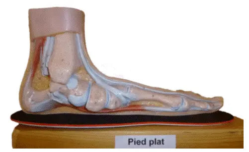 Semelles orthopédiques sur mesure pour pieds plats / sur RDV